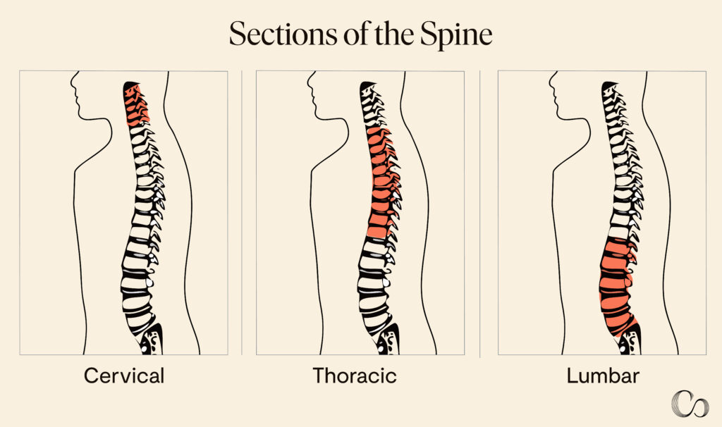 Sections of the spine: cervical, thoracic, lumbar. Artificial disc replacement surgery typically takes place in the cervical or lumbar regions of the spine.