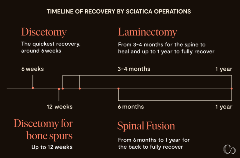 Sciatica Surgery 101: A Guide to Sciatica Surgery - Commons Clinic