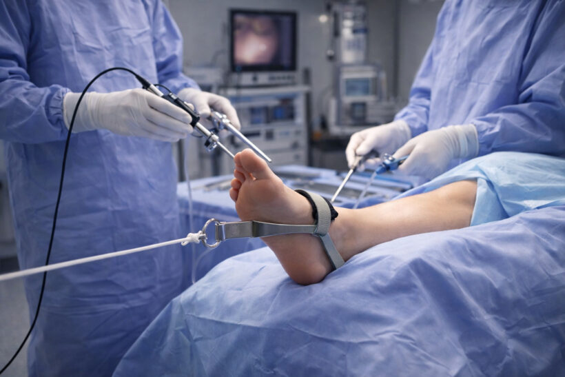 Patient’s foot elevated and secured in a traction device during ankle arthroscopy in a modern operating room, with sterile blue drapes covering the body and a surgeon and assistant using an arthroscope and surgical instruments under bright clinical lights. surgery ankle arthroscopic repair ankle arthroscopy recovery lesions surgery ankle ankle arthroscopic repair ankle fracture surgery ankle surgical procedure arthroscopy ankle arthroscopic repair spinal fracture ankle arthroscopy ankle arthroscopic repair ankle ankle arthroscopic repair arthroscopy lesions ankle arthroscopic surgery ankle arthroscopic repair ankle ankle arthroscopic repair ankle surgery ankle problems ankle arthroscopic repair ankle arthroscopic repair lesions ankle ankle problems arthroscopy arthroscopy ankle