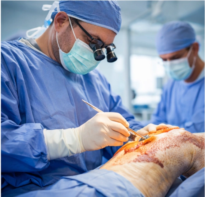Orthopedic surgeon performing partial knee replacement surgery in a modern operating room knee replacement arthroscopic partial knee replacement knee replacement total knee replacement knee replacement knee replacement arthroscopic partial knee replacement total knee replacement knee replacement knee replacement arthroscopic partial knee replacement knee replacement arthroscopic partial knee replacement partial knee replacement arthroscopic partial knee replacement knee replacement arthroscopic partial knee replacement total knee replacement arthroscopic partial knee replacement navigation total knee replacement knee replacement total knee replacement arthroscopic partial knee replacement robotics arthroscopic partial knee replacement knee replacement arthroscopic partial knee replacement arthroscopic partial knee replacement total knee replacement knee replacement total knee replacement knee replacement knee replacement total knee replacement total knee replacement partial knee replacement arthroscopic partial knee replacement knee joint knee joint total knee replacement partial knee replacement knee replacement partial knee replacement knee joint partial knee replacement partial knee replacement total knee replacement